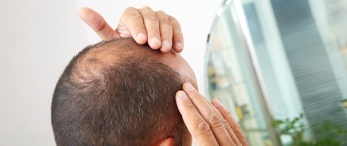 caduta dei capelli farmacia