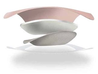 Image of Aquacel Ag Foam Schaumverband adhäsiv Ferse 5 Stk