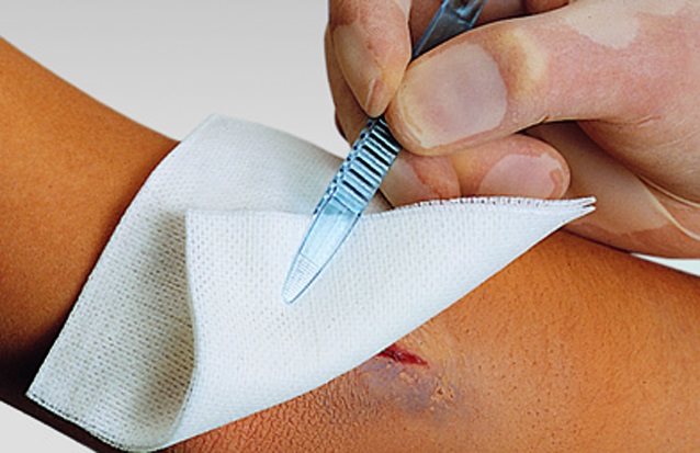 Image of Vliwasoft Vliesstoffkompressen 7.5x7.5cm 4-lagig steril 75 x 2 Stk