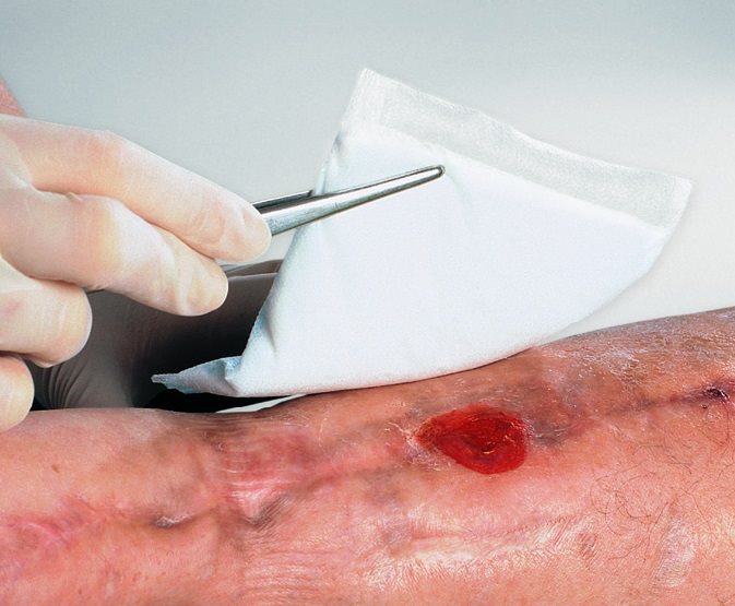 Vliwazell compresse absorbante 20x20cm stérile 30 pce