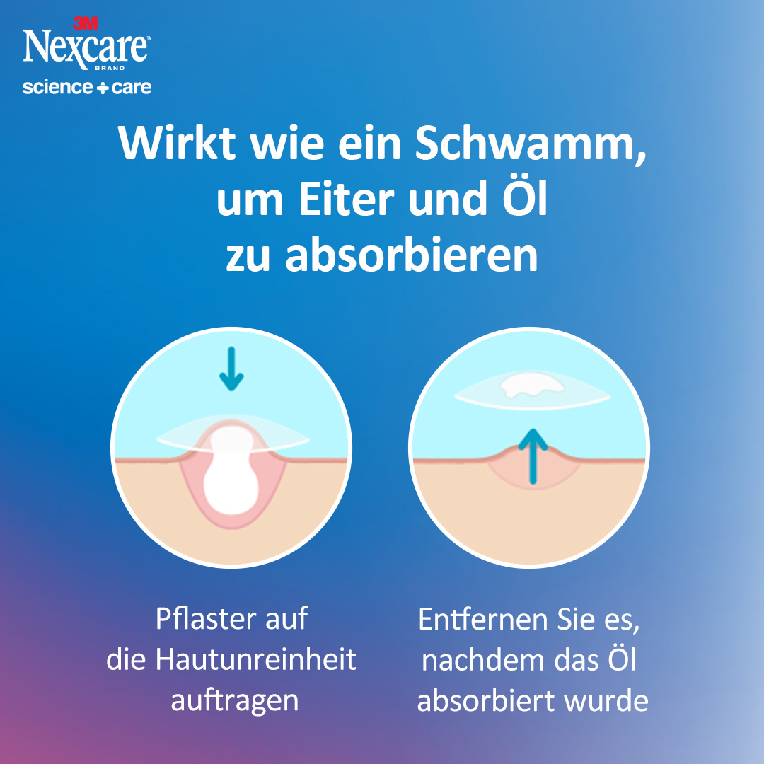 3M Akne-Pflaster, Bild 3 von 5