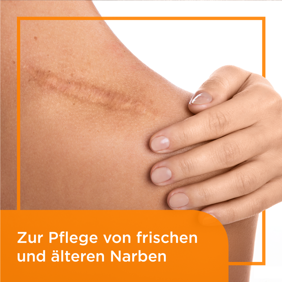 BEPANTHEN DERMA Narben-Gel, Bild 2 von 6