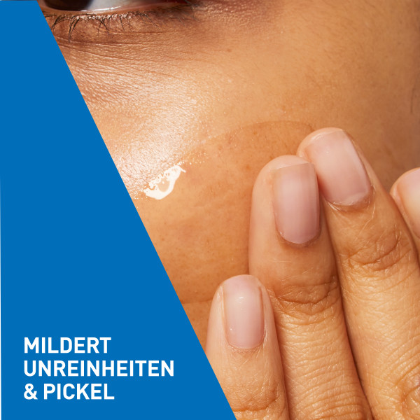 CERAVE Anti-Unreinheiten Gel, Bild 4 von 6