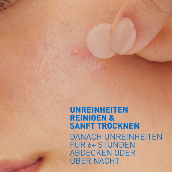CERAVE Anti-Unreinheiten Patches, Bild 3 von 5
