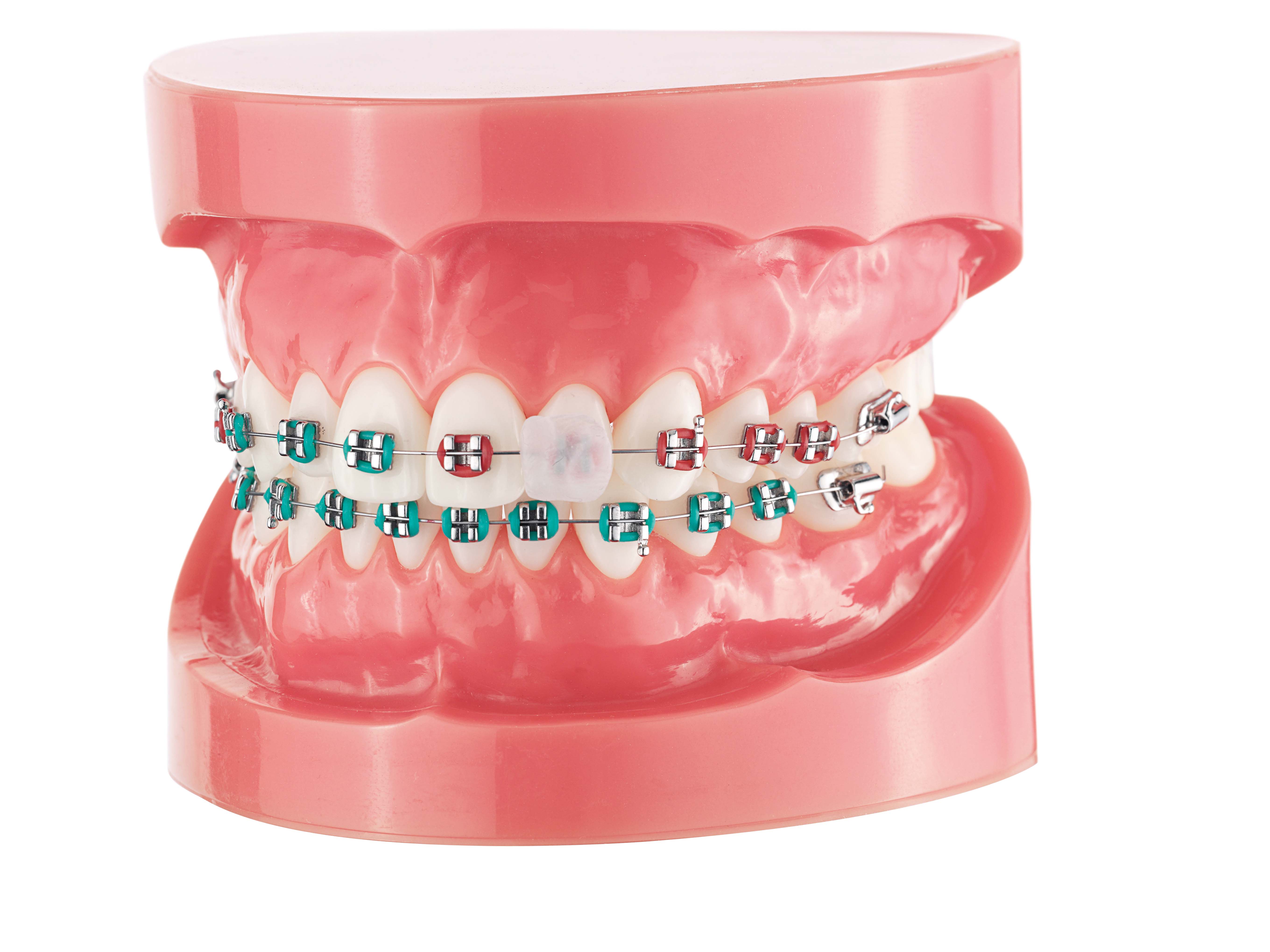 CURAPROX cire orthodontique, image 4 sur 4