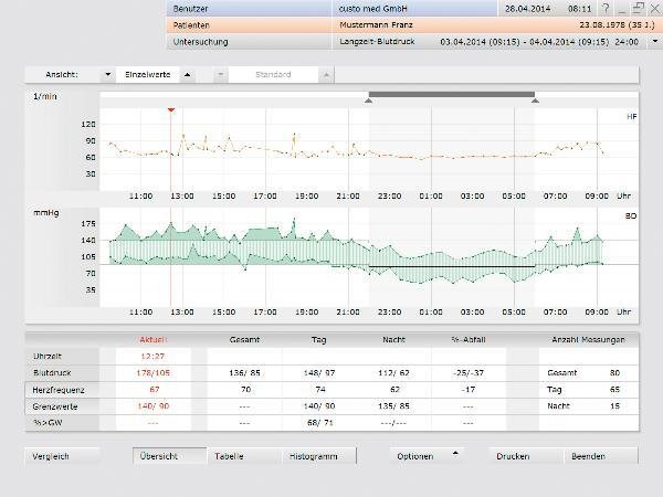 Custo Med custo screen standard Software