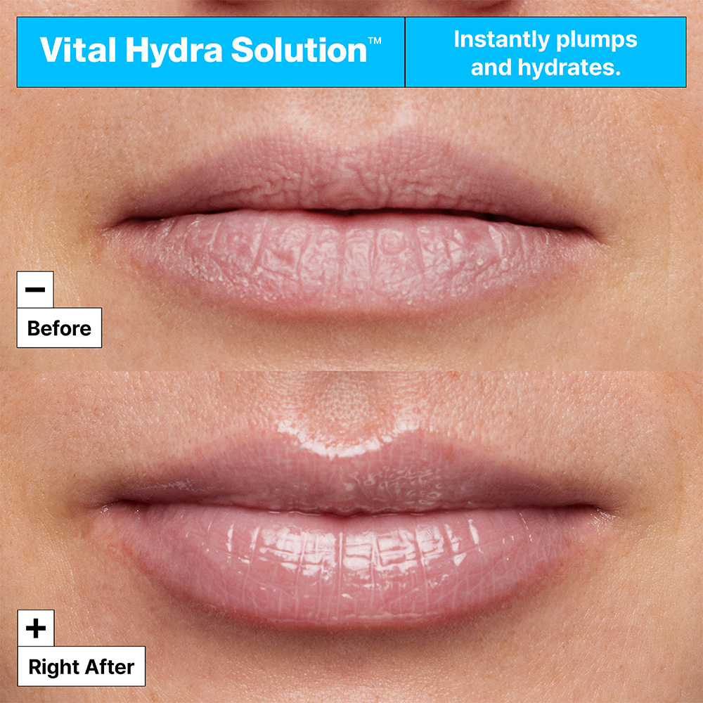DR.JART Vital Hydra Solution Hydrating Lip Mask, image 5 sur 5