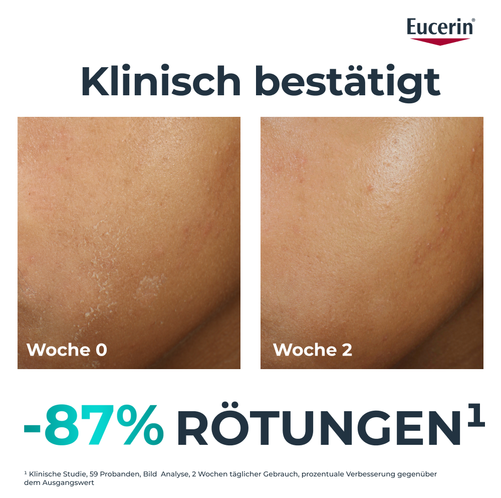 EUCERIN Dermopure Clinical Feuchtigkeitspflege, Bild 3 von 5