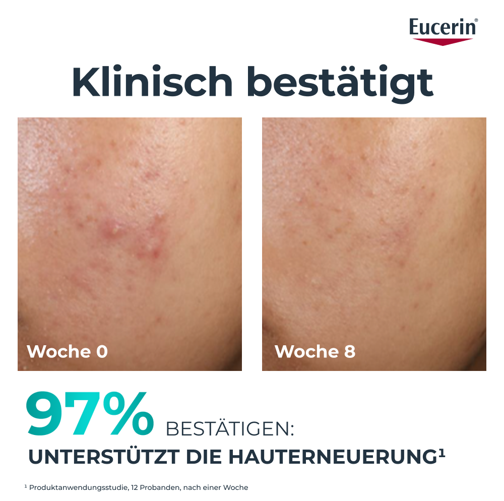 EUCERIN Dermopure Clinical Peeling 10 Nachtpflege, Bild 4 von 5