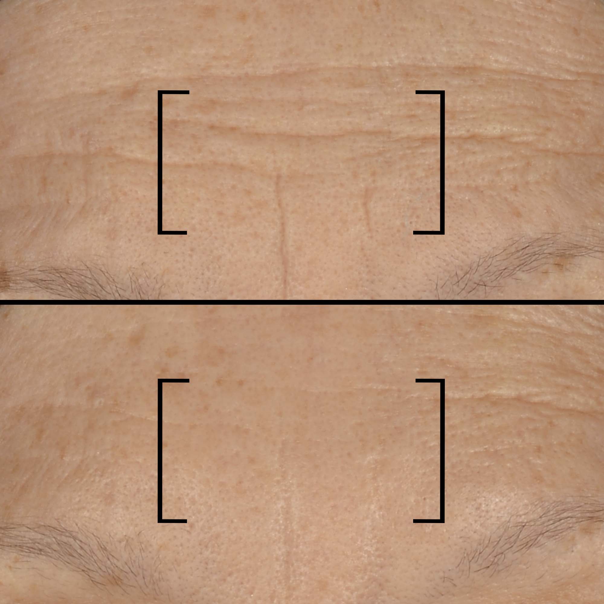 FILORGA TIME FILLER 5X  Cream Clean, Bild 4 von 5