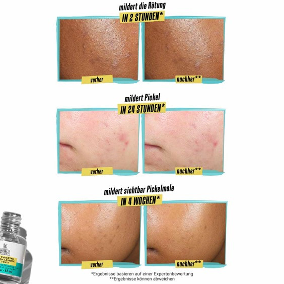 KIEHL'S Acne Clearing Solution, Bild 3 von 3