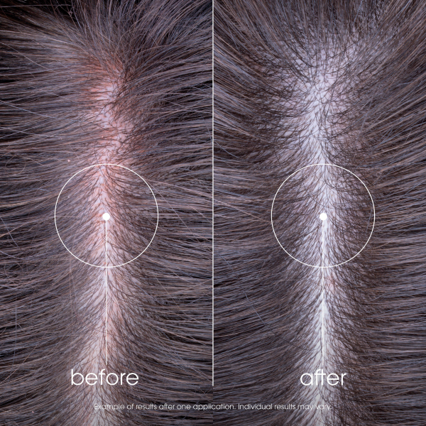 Klorane Shampoo, Bild 3 von 6